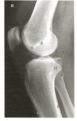 Два мыщелка. Анатомия надколенника на рентгене. Рентгенограмма коленного сустава в норме в боковой проекции. Рентген коленного сустава в боковой проекции Кишковский. Рентген коленного сустава в боковой проекции.